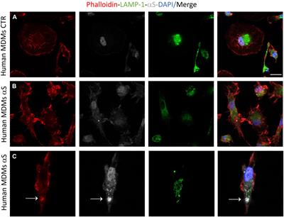 Alpha-synuclein shapes monocyte and macrophage cell biology and functions by bridging alterations of autophagy and inflammatory pathways